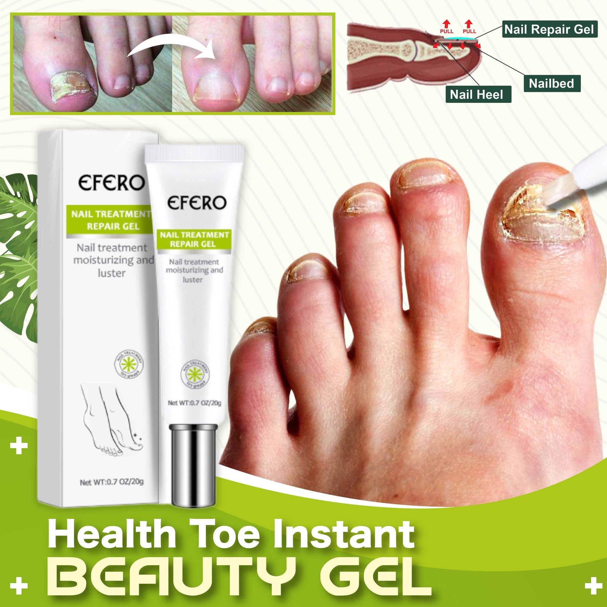 Toe Repair™ Gel réparateur Toe Be Health (1+1 Gratuit !)
