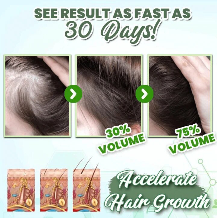 HerbalRevive™ Essence à base de plantes pour la croissance des cheveux en spray (1+1 GRATUIT)