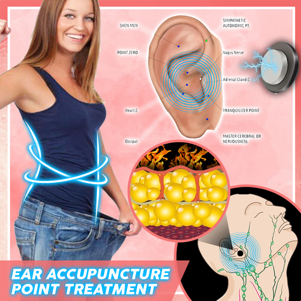 SlimRings™ Boucles d'oreilles amincissantes magnétiques