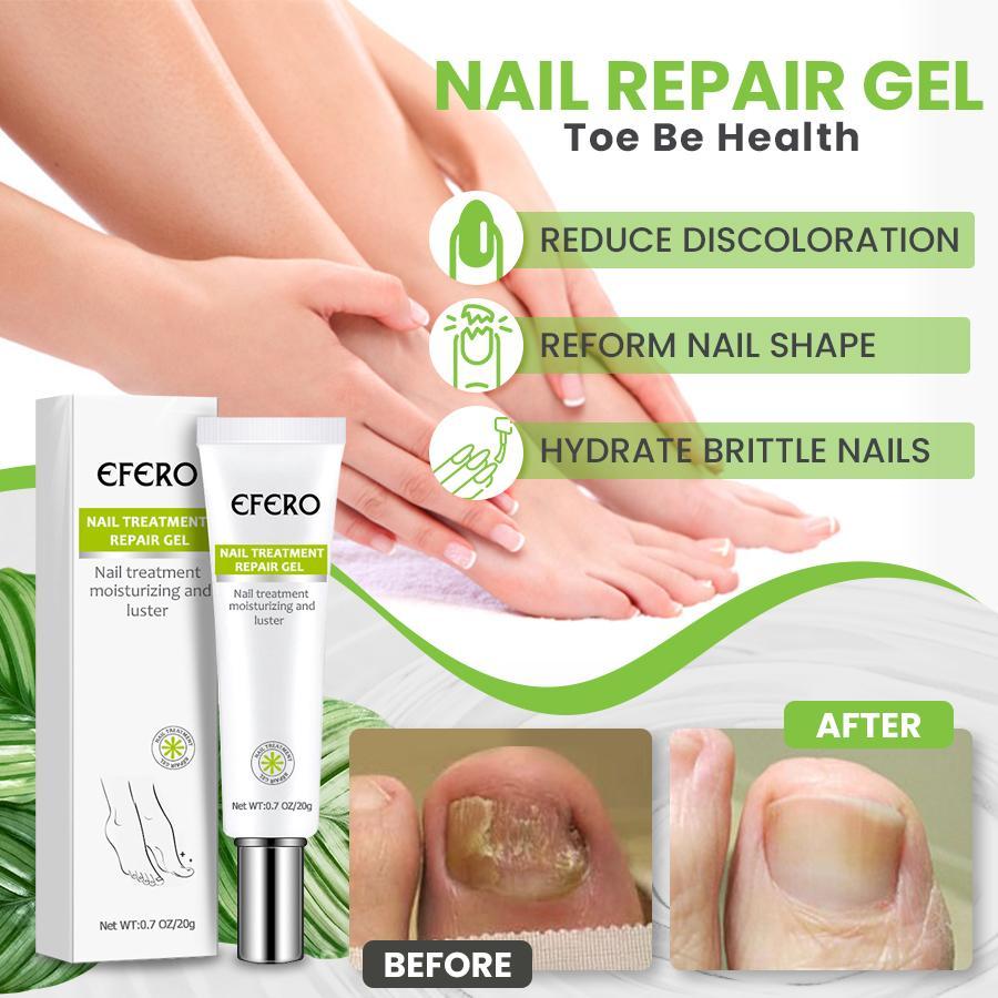 Restore Nail™ Gel réparateur d'ongles antifongique (1+1 Gratuit)