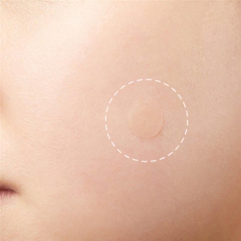 Skin Patch™ Patch anti-tags (36 Pièces)