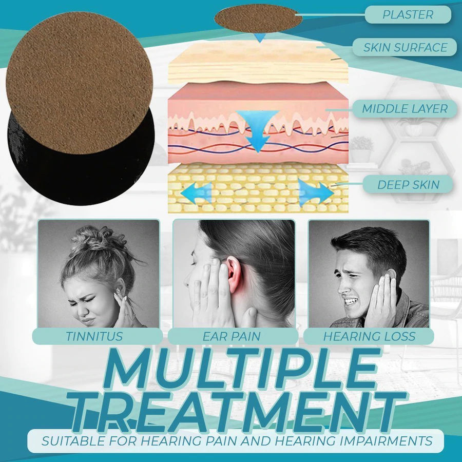 CalmNerve™ Patch d'oreille pour le traitement des acouphènes