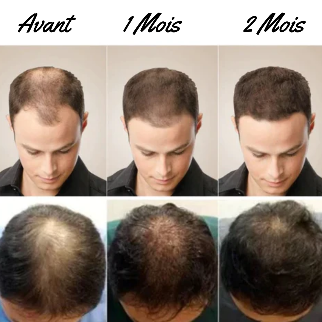 HairNourisher™ Shampooing professionnel biologique pour la croissance des cheveux | 1+1 GRATUIT