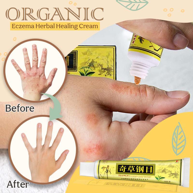 Organic Heal™ Crème de traitement à base de plantes pour l'eczéma biologique (1+1 GRATUIT !)