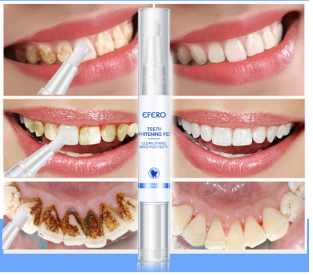 MaxBright™ - Stylo de blanchiment des dents (1+1 GRATUIT)
