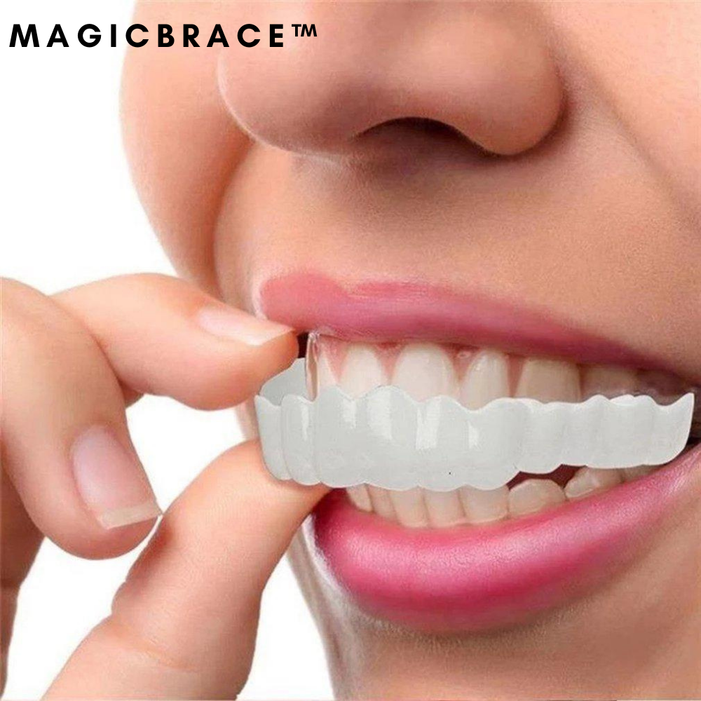 MagicBrace™ - Facettes dentaires (1+1 GRATUIT)